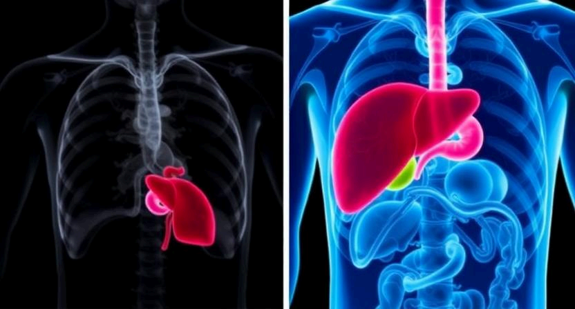 liver-cirrhosis-causes-symptoms-where-to-get-help